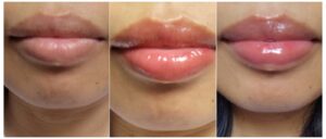 A sequential photo showing the lip serum shades on the lips